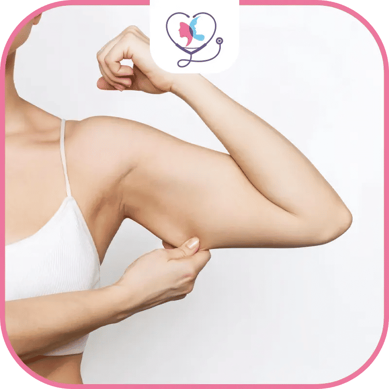 liposuccion bras en Turquie - liposuccion bras