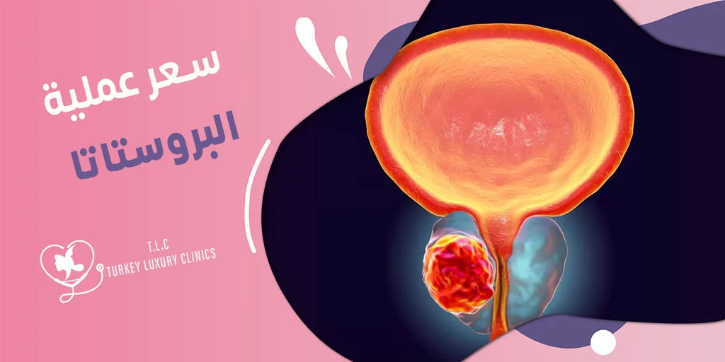 سعر عملية البروستاتا: مقارنة بين تركيا والسعودية وباقي الدول