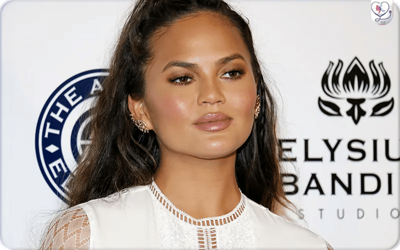 Chrissy Teigen:
