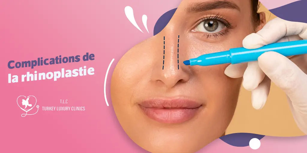 Complications de la rhinoplastie