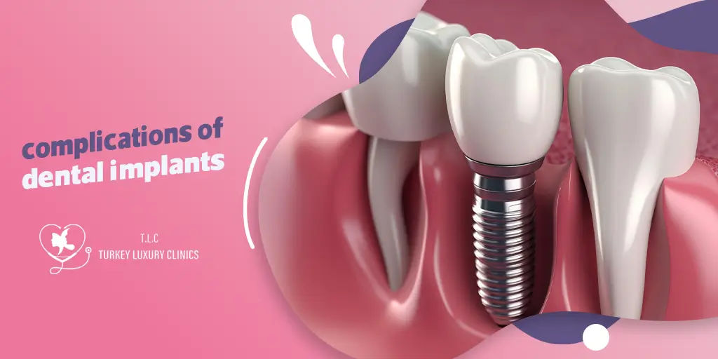 Addressing Concerns: Managing Potential Risks and Complications of Dental Implants