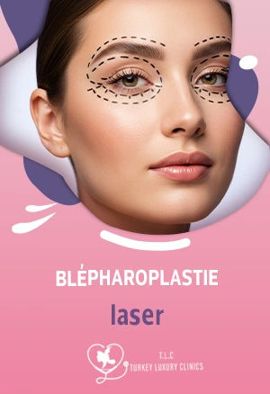 Blépharoplastie laser : technique, les prix, les avis et les résultats avant/après