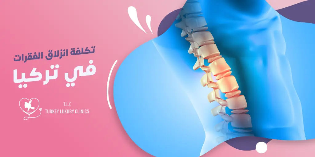 تكلفة جراحة انزلاق الفقرات في تركيا