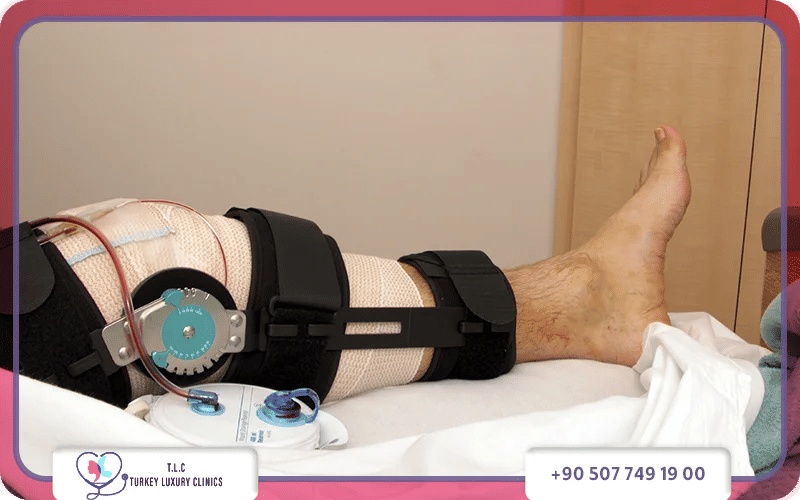 شكل الركبة بعد عملية الرباط الصليبي