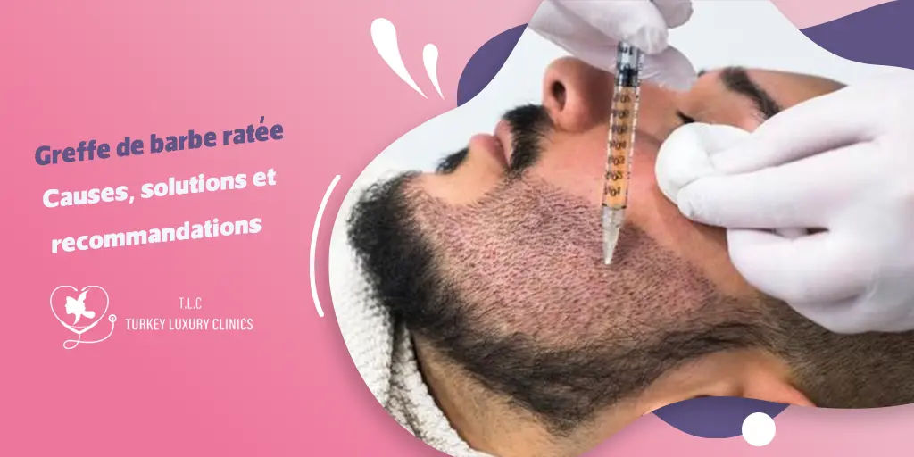 Greffe de barbe ratée : Causes, solutions et recommandations