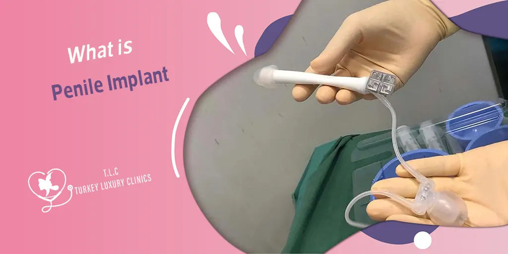 What is a Penile Implant? 2026 Types, Cost, Recovery & Results