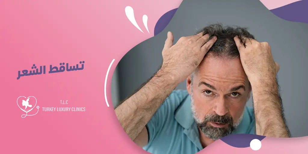 كيفية علاج تساقط الشعر في تركيا