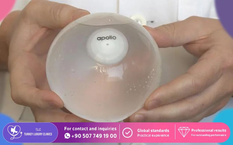 Orbera Gastric Balloon