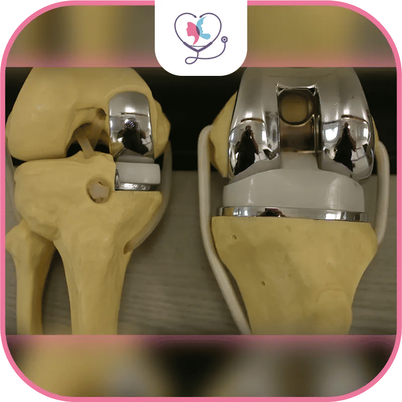 Partial vs. Total: Can I Choose?