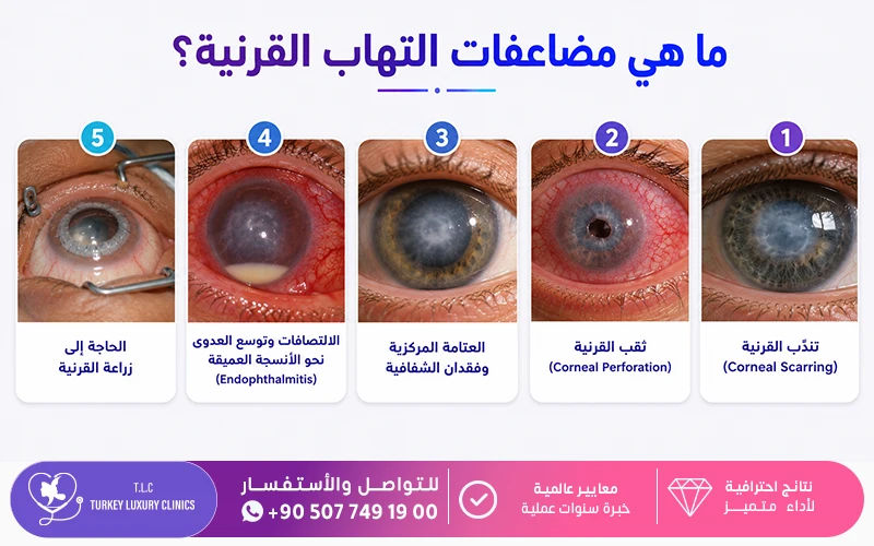 ما هي مضاعفات التهاب القرنية؟ ما هي مضاعفات التهاب القرنية؟