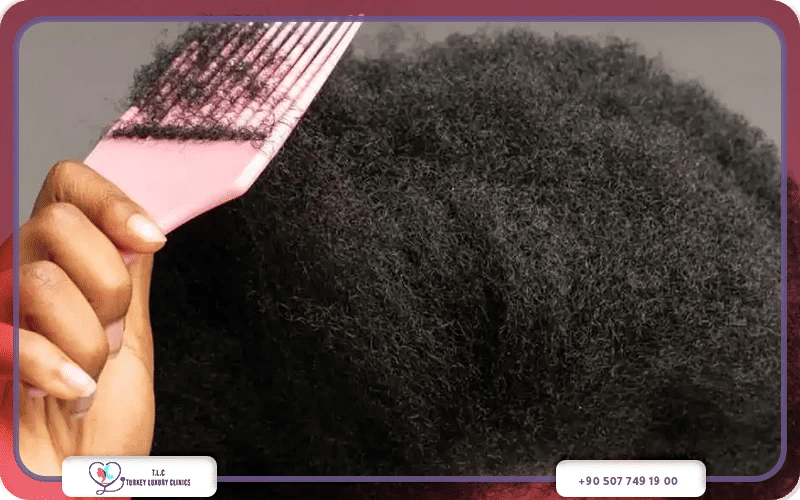 مخاطر زراعة الشعر الأفريقي