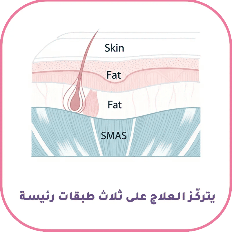 الطبقات التشريحية للوجه في شد الوجه غير الجراحي الجلد، الدهون وطبقة SMAS 