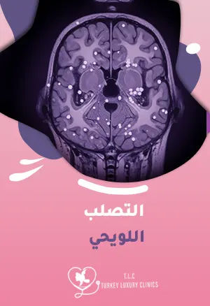 التصلب اللويحي: أعراضه المبكرة وخيارات العلاج الفعالة