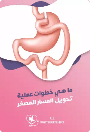 ما هي خطوات عملية تحويل المسار المصغر؟featured image