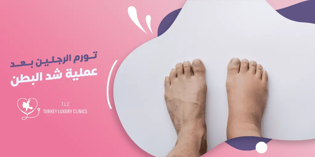تورم الرجلين بعد عملية شد البطن