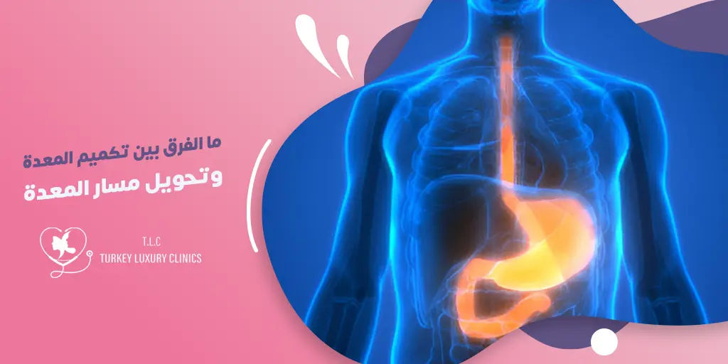 ما الفرق بين تكميم المعدة وتحويل مسار المعدة