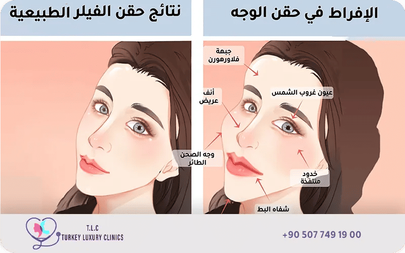 اضرار الحقن الزائد