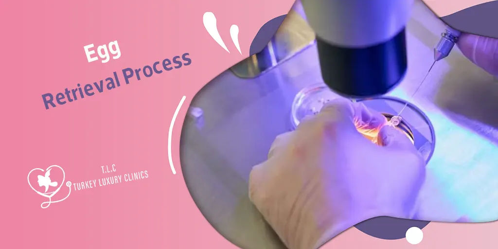 Egg Retrieval Process: Step-by-Step, Before, During, and After IVF