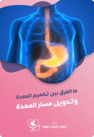ما الفرق بين تكميم المعدة وتحويل مسار المعدةfeatured image