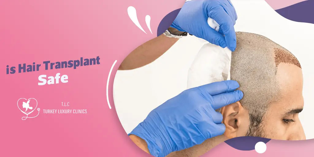 Ist Haartransplantation sicher