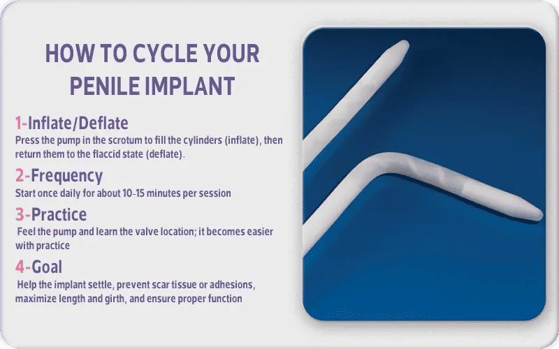 When to Start Cycling Your Penile Implant After Surgery?