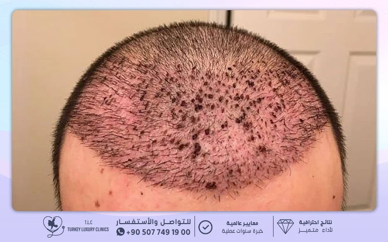 الأسبوع الأول