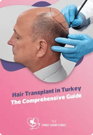 Haartransplantation in der Türkei: Vollständiger Leitfadenfeatured image