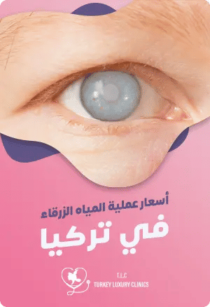 تكلفة جراحة الجلوكوما في تركياfeatured image
