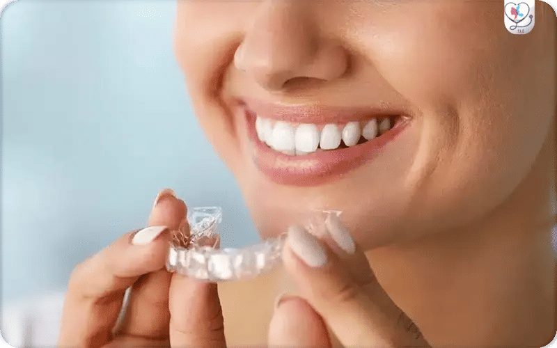 تجربتي مع تقويم الأسنان