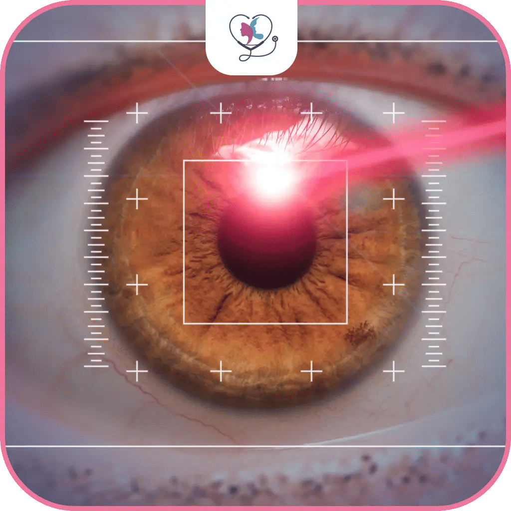 ما قبل جراحة اعتلال الشبكية السكري