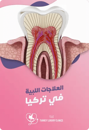 العلاجات اللبية في تركياfeatured image