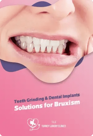 Teeth Grinding & Dental Implants: Solutions for Bruxism
