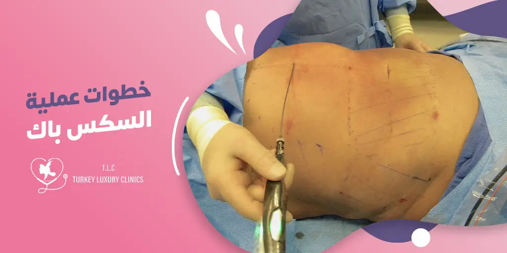 خطوات عملية Six-Pack