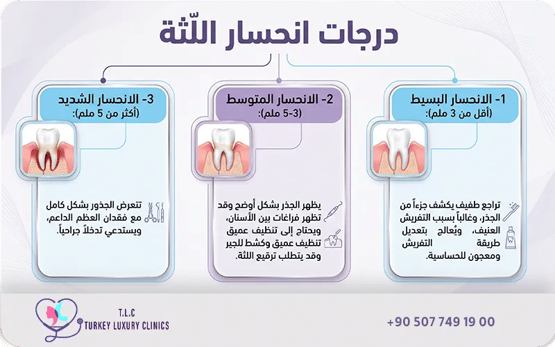 درجات انحسار اللثة