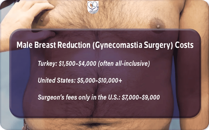 Male Breast Reduction (Gynecomastia Surgery) Costs
