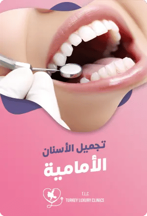 تجميل الأسنان الأمامية featured image