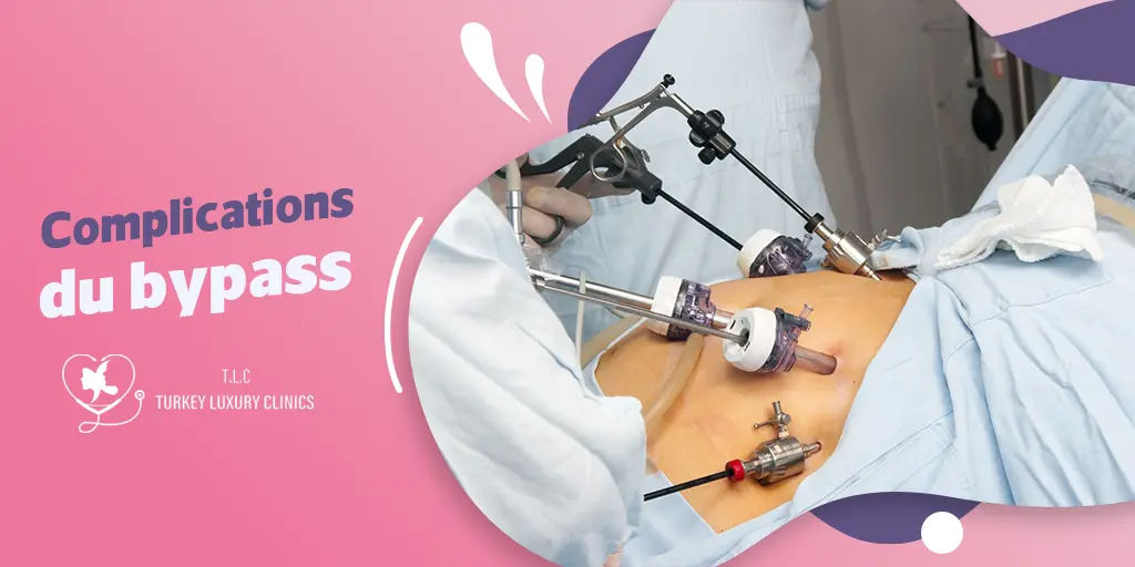 Complications du bypass : Effets immédiats et à long terme