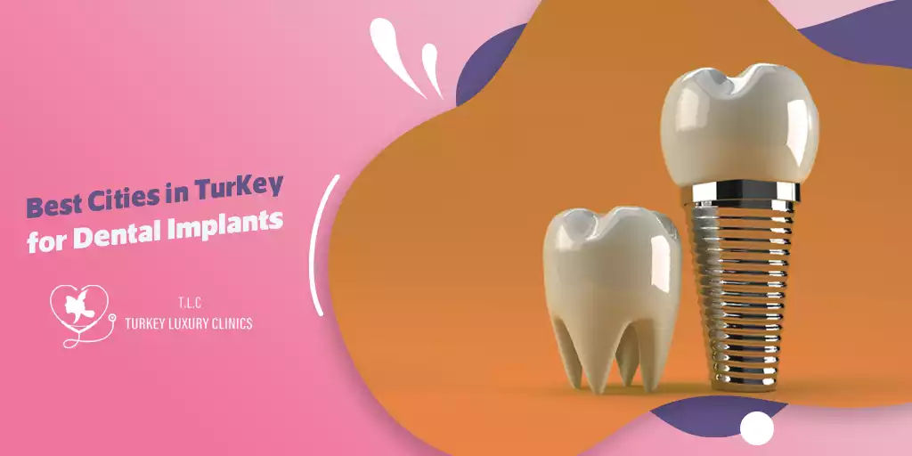 Mejores Ciudades en Turquía para Implantes Dentales