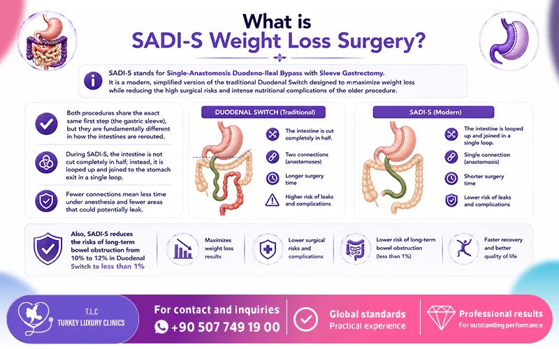 What is SADI-S Weight Loss Surgery?
