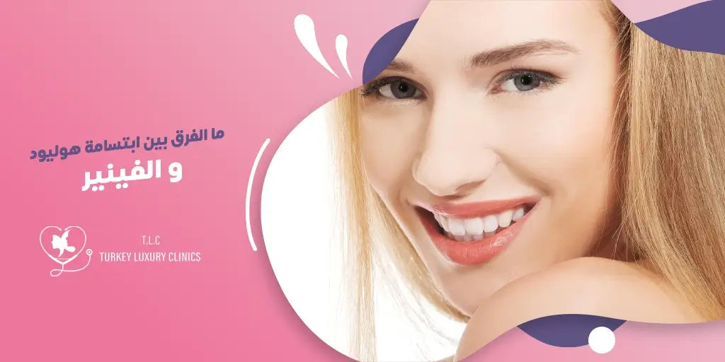 ما الفرق بين ابتسامة هوليود والفينير؟
