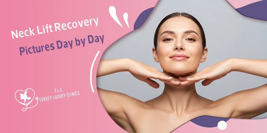 Neck Lift Recovery Pictures Day by Day (Day 1 to Month 12)