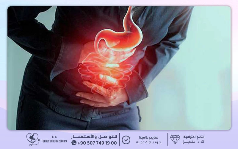 ضطرابات المعدة