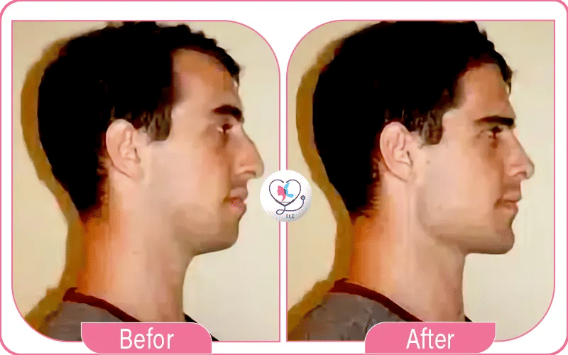 تكساس الوجه للرجال