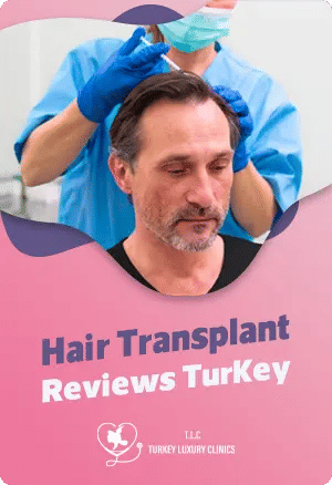 Hair Transplant Reviews Turkey
