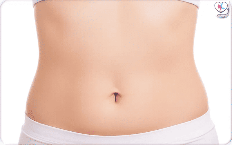 Repositioning of the Belly Button During Tummy Tuck