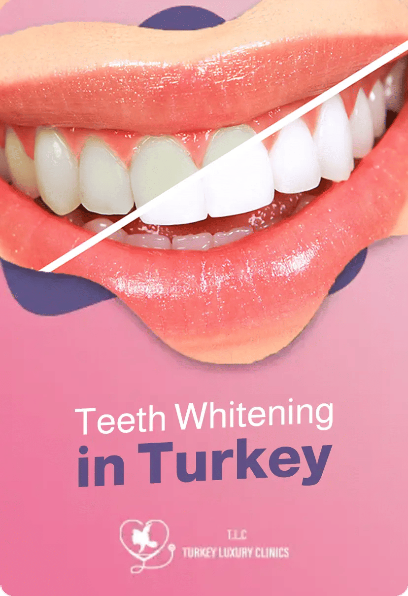 Teeth Whitening Turkey: Affordable Costs for a Brighter Smile 2026