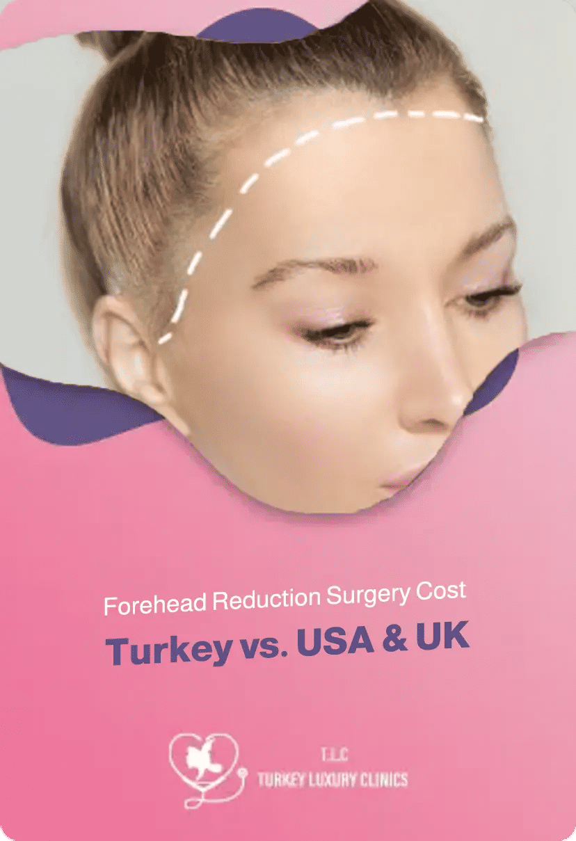 Forehead Reduction Surgery Cost: Turkey vs. USA & UK [2026 Prices]