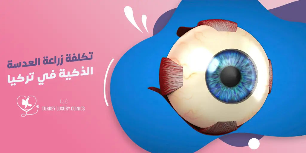 تكلفة زراعة العدسة الذكية في تركيا: فهم التكاليف والمزايا