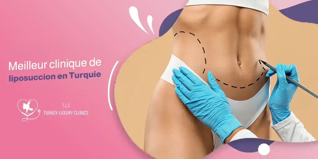 Meilleur clinique de liposuccion en Turquie 2026: guide complet
