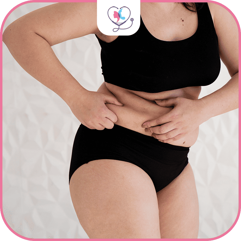 liposuccion ventre turquie tarif - liposuccion istanbul prix